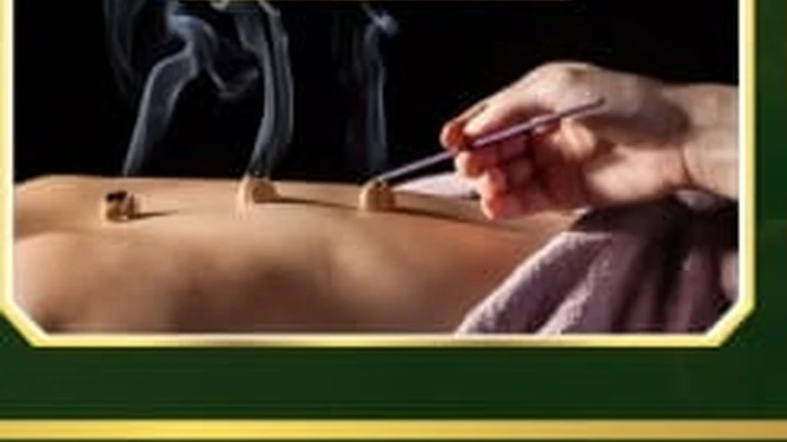 Ilustrasi Therapy Moxibusi